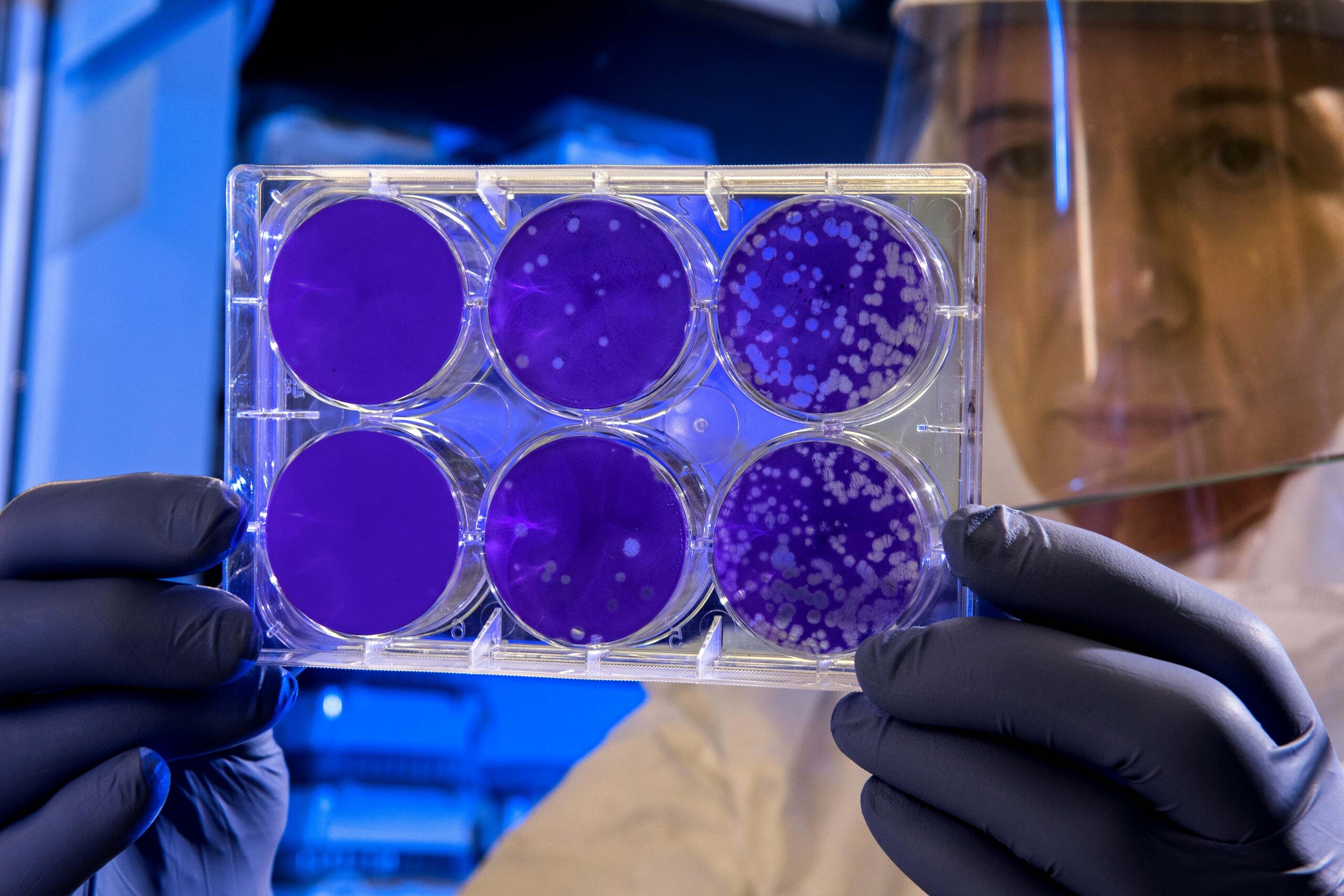 Scientist with protective visor holds a petri dish with cell cultures and bacterial colonies.