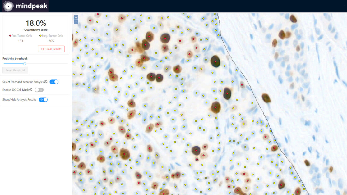 Hamburg's Mindpeak using AI to diagnose cancer — Hamburg-business.com